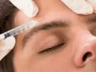 Interesting Facts You Need To Know About Botox For Migraines