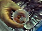 Kidney Stone Surgery